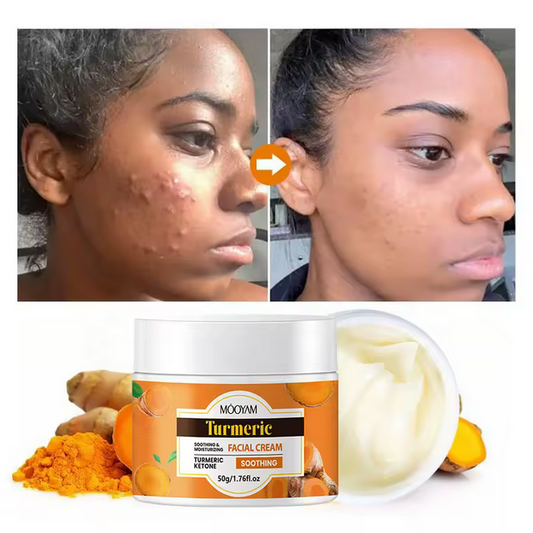 Crème Visage au Curcuma – Éclat, Anti-Acné & Anti-Taches