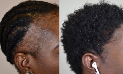 Batana Oil – L’Huile Ancestrale qui Transforme les Cheveux