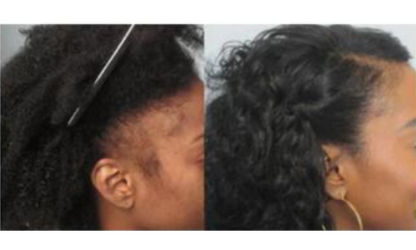 Batana Oil – L’Huile Ancestrale qui Transforme les Cheveux