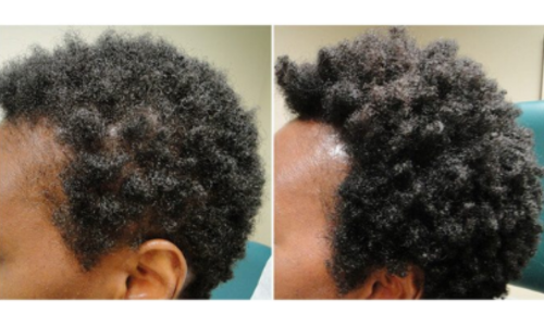 Batana Oil – L’Huile Ancestrale qui Transforme les Cheveux