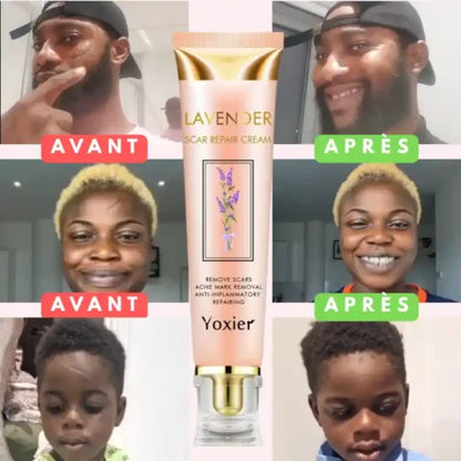 Crème Réparatrice pour Cicatrices & Vergetures