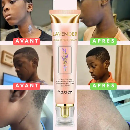 Crème Réparatrice pour Cicatrices & Vergetures
