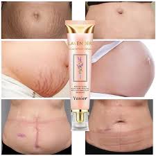 Crème Réparatrice pour Cicatrices & Vergetures